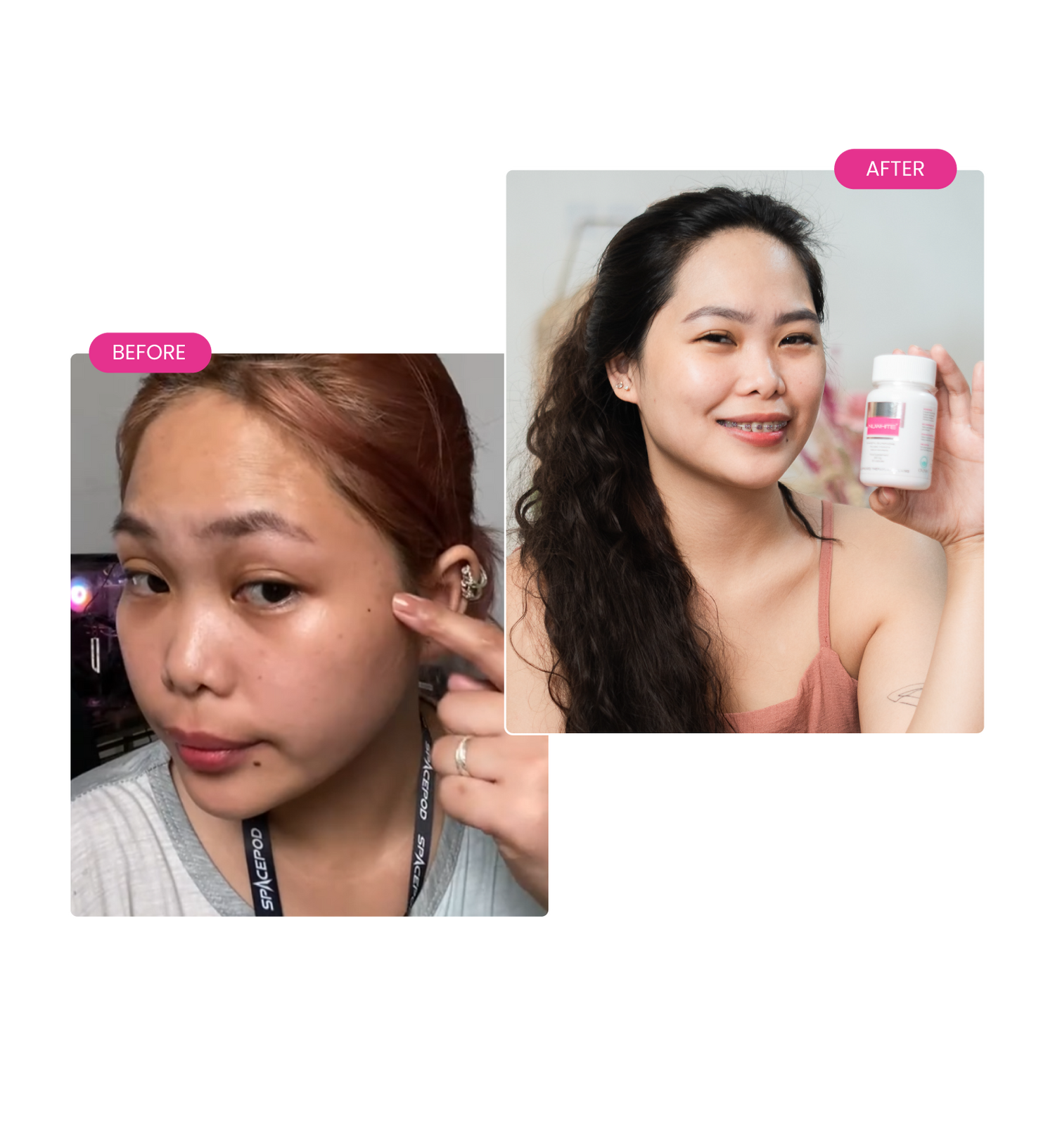 nuwhite glutathione review before and after My 21 day oral results (Before & After) : r/IndianSkincareAddicts Wondering what a week of